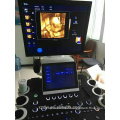 2D 3D 4D Echocardiography Ecografo Ultrasound